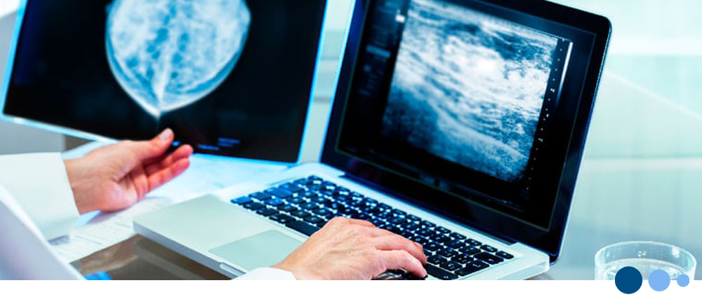 Telerad - Diagnóstico por imágenes en la prevención del cáncer de mama