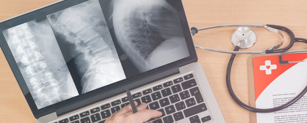 Telerad IA cuáles son los nuevos paradigmas tecnológicos en radiología