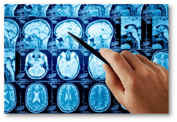 telerad_cerebro