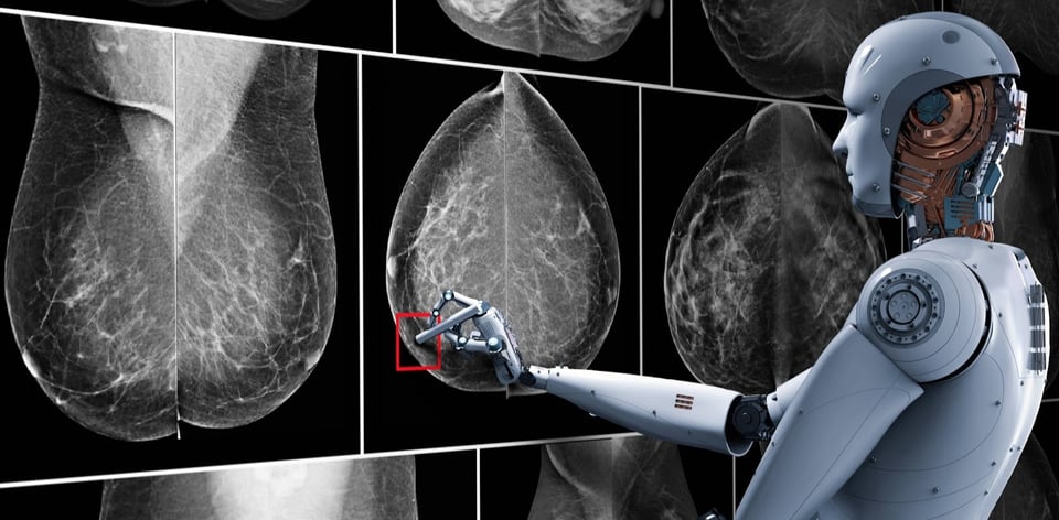 telerad_inteligenciaartificial_mamografia