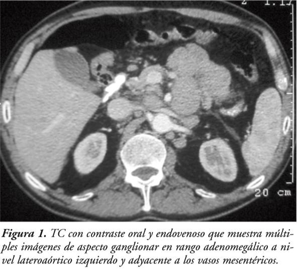 Telerad caso clínico diagnostico por imagen  