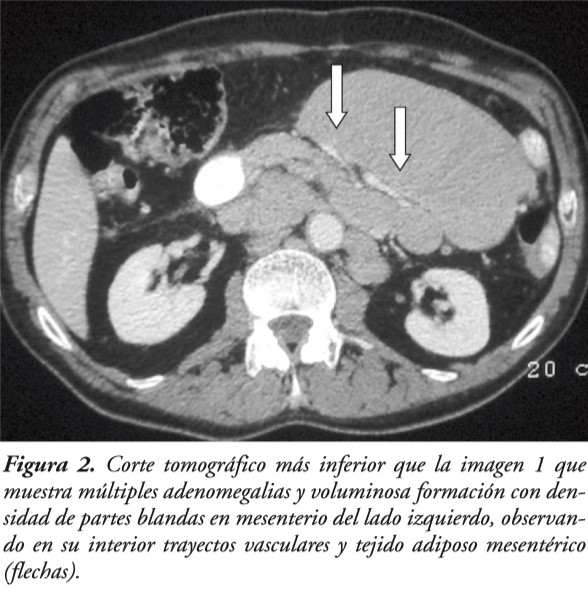 Telerad caso clínico diagnostico por imagen  